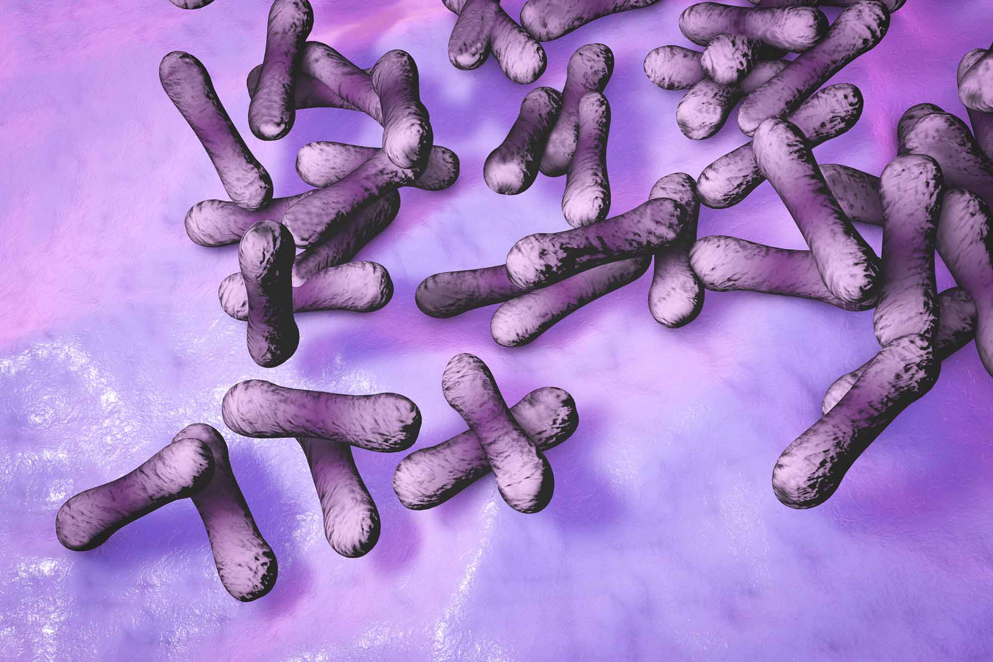 Дифтерия Дифтерия