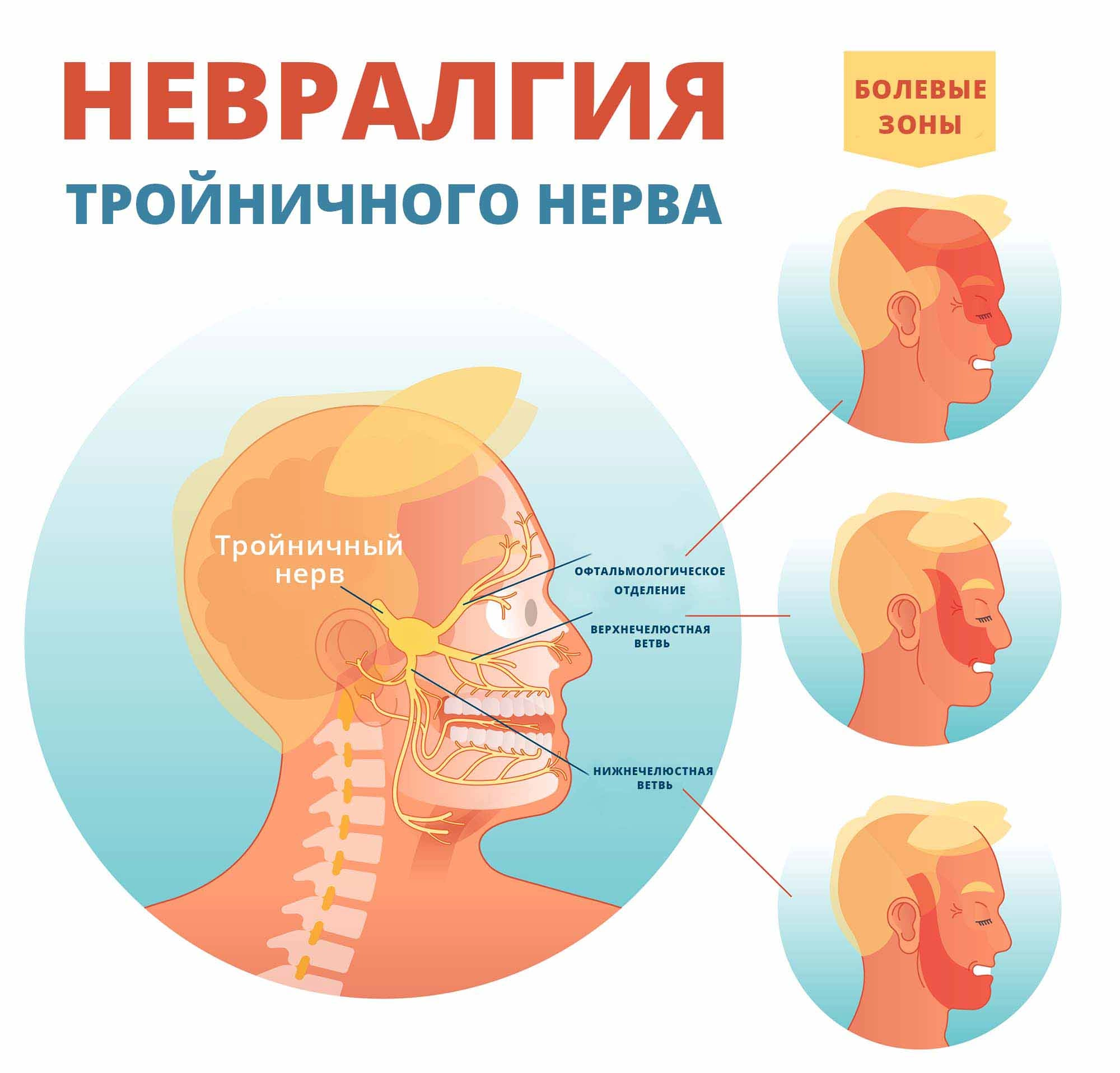 Невралгия тройничного нерва: причины, симптомы, классификация, чем опасна,  терапия, профилактика