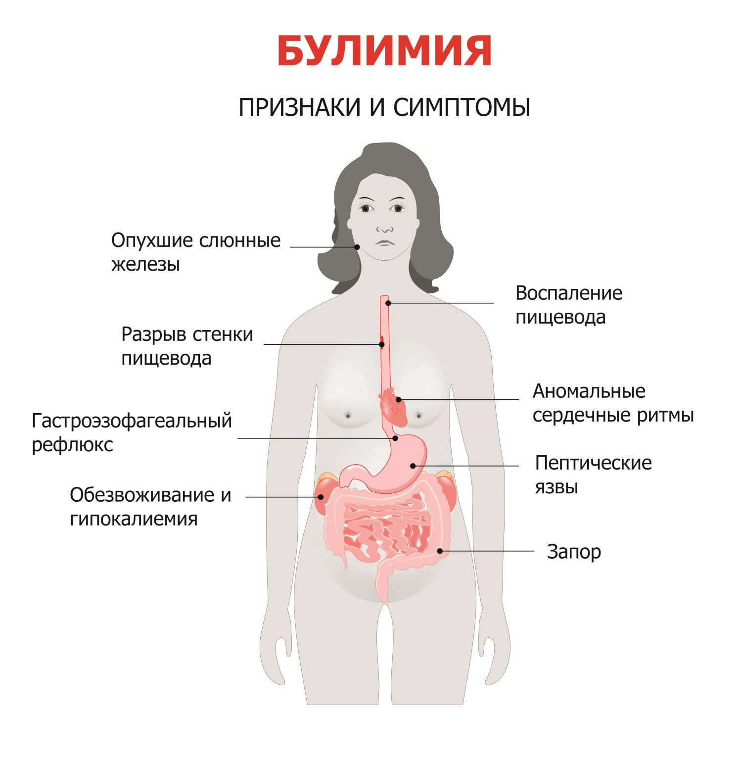 Пищевые расстройства что это. Пищевое расстройство симптомы. Признаки пищевого расстройства.