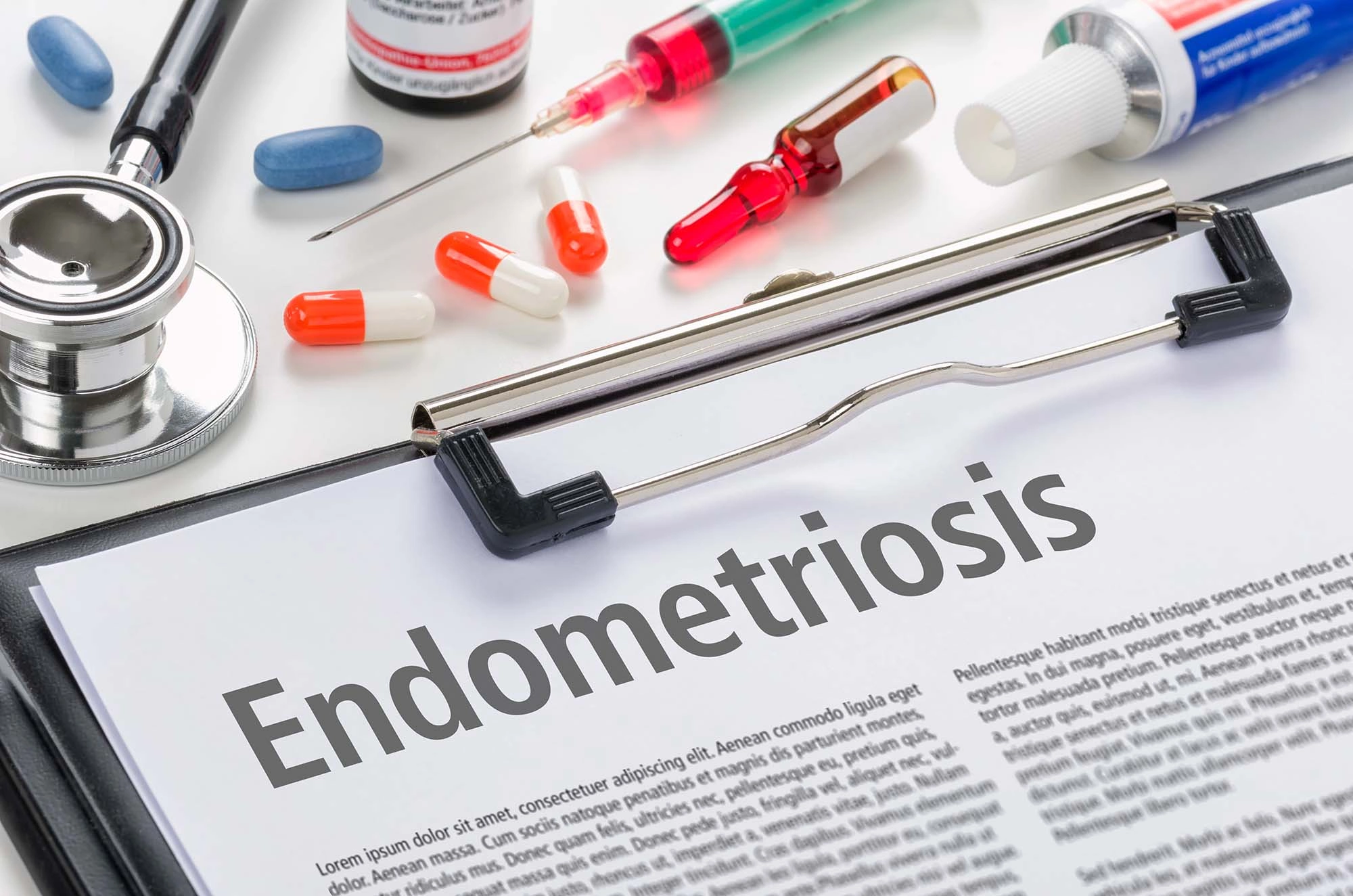 Формы эндометриоза