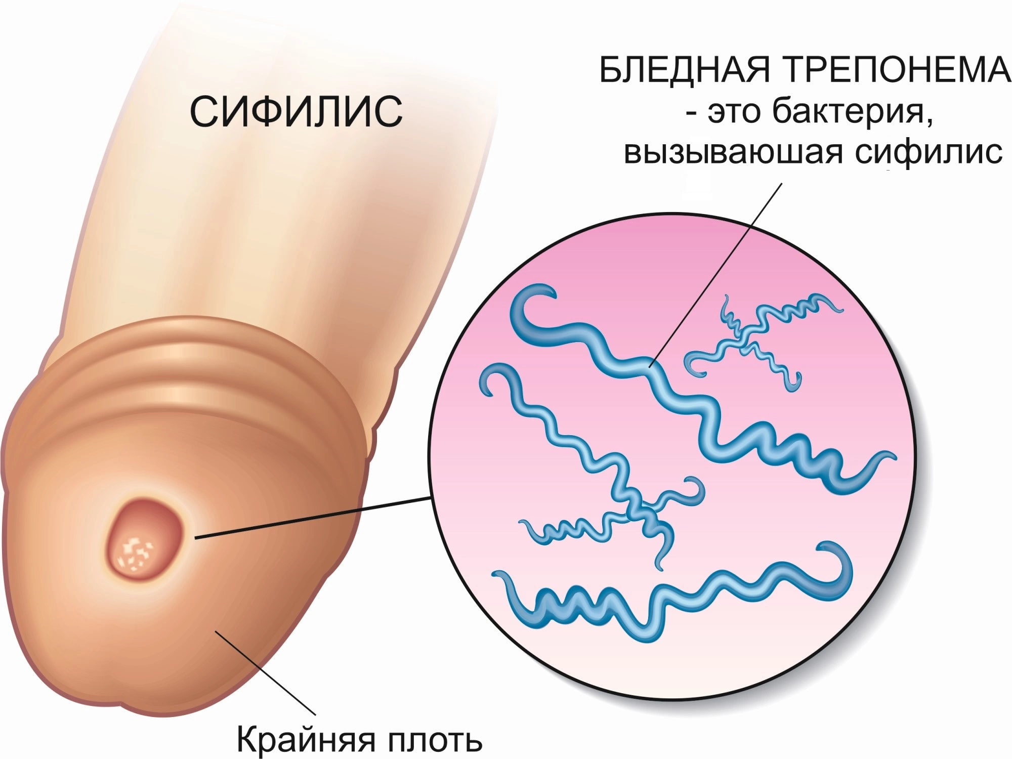 можно ли заразиться венерическими заболеваниями при мастурбации фото 60