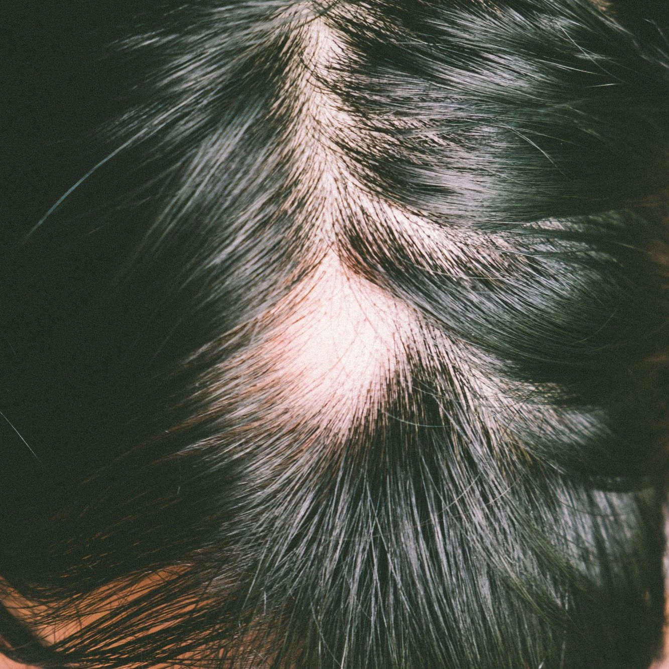 5 привычек, которые могут привести к выпадению волос