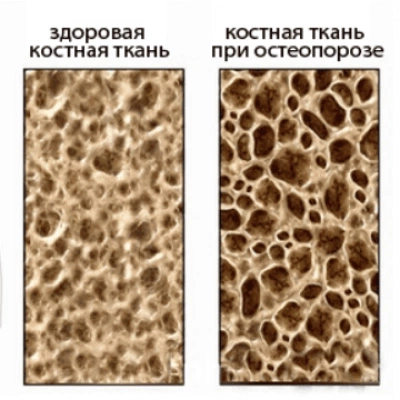 Эффективные народные средства лечения (2) (комплект)